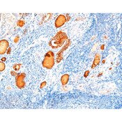 Thyroglobulin (Tg)